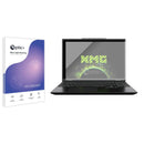 Blue Light Blocking Screen Protector for XMG Evo 15.