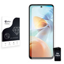 Screen Protector for Nubia Music 2